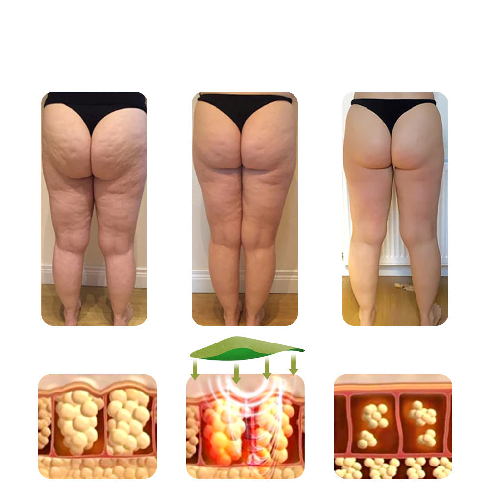 Cellulite Patches Body Care Smoother Firmer Skin