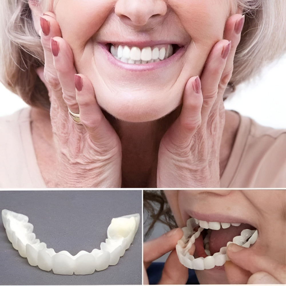 Tand Facetas Clipe em Próteses Dentárias Correção de Sorriso