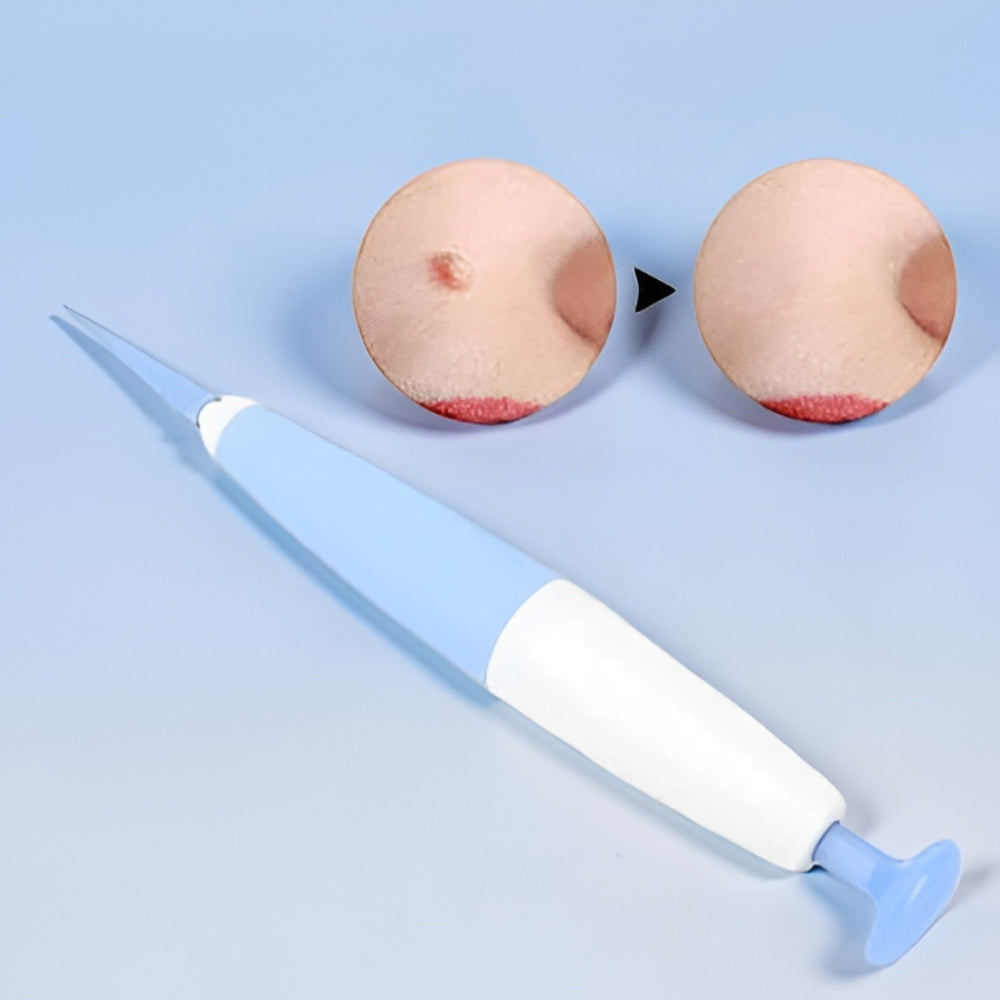 Skin Tag Remover Tool Home Care Precision Applicator