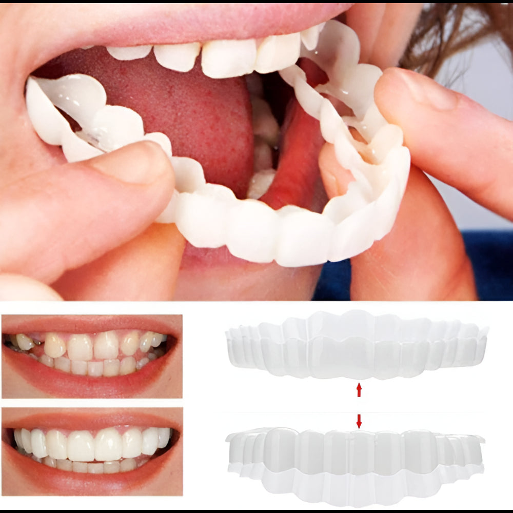 Tooth Veneers Denture Clip-In Denture Smile Correction